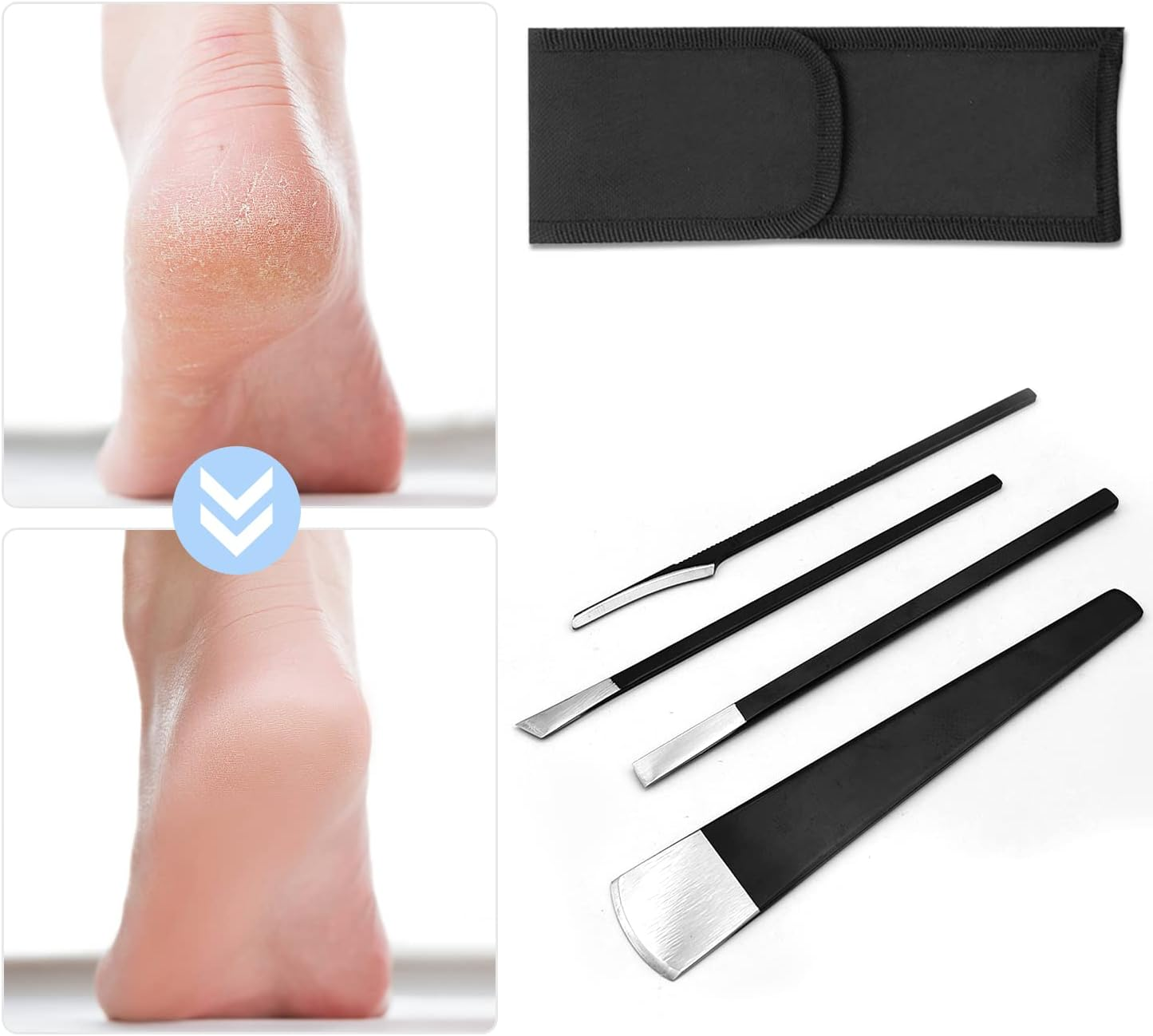 4 PCS Pedicure Knife Set Stainless Steel Ingrown Toenail Knife Correction Foo... - Picture 4 of 9