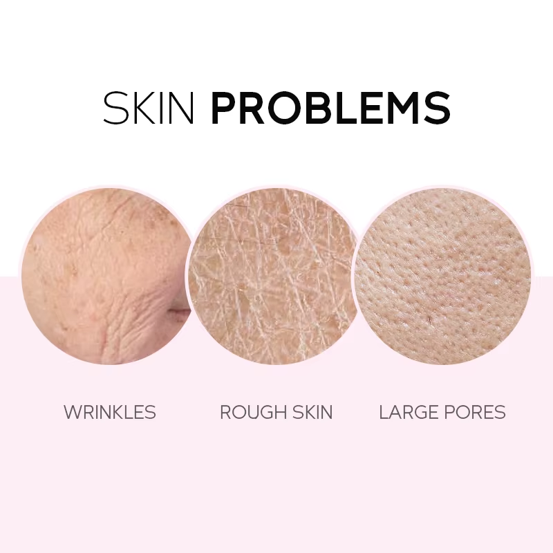 Private Label Anti-Acne Dark Spot Remover Face Toner Serum Skincare Set 5Pc Custom Whitening Niacinamide Vitamin C Inspired