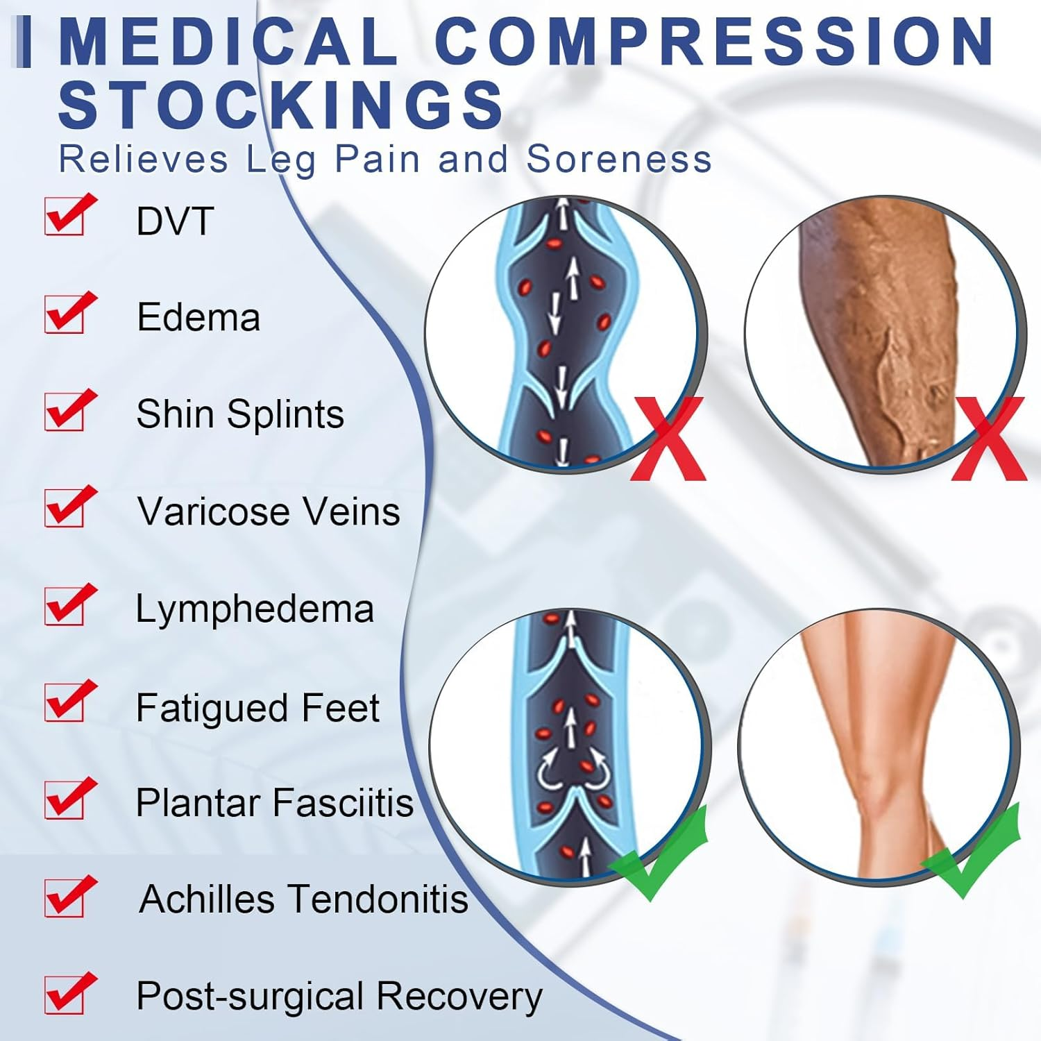 Beister Compression Stocking 20-30 mmHg for Women & Men, 1 Pair Open Toe Thig... - Picture 8 of 22