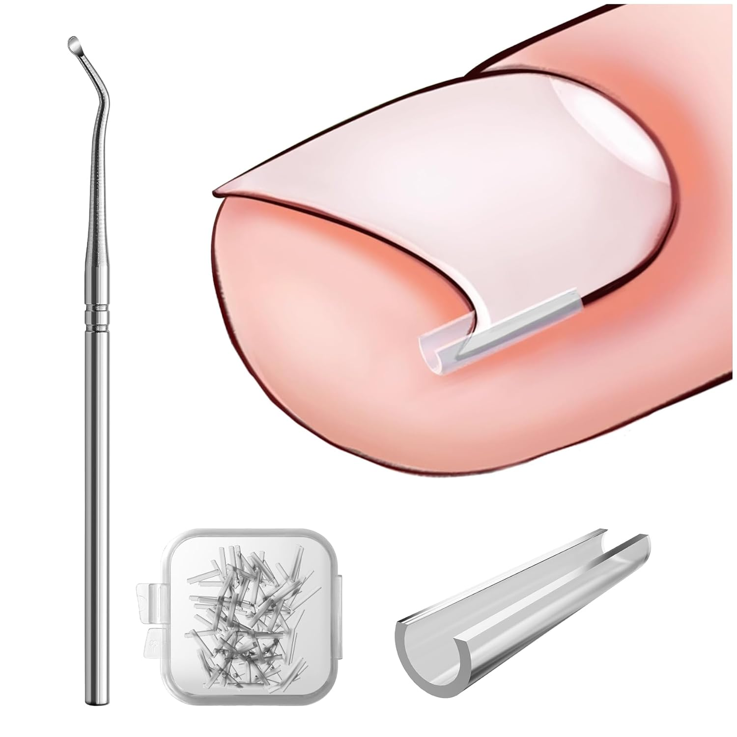 Ingrown Toenail Corrector Set - 40 Pain-Free Straightener Strips with Lifter