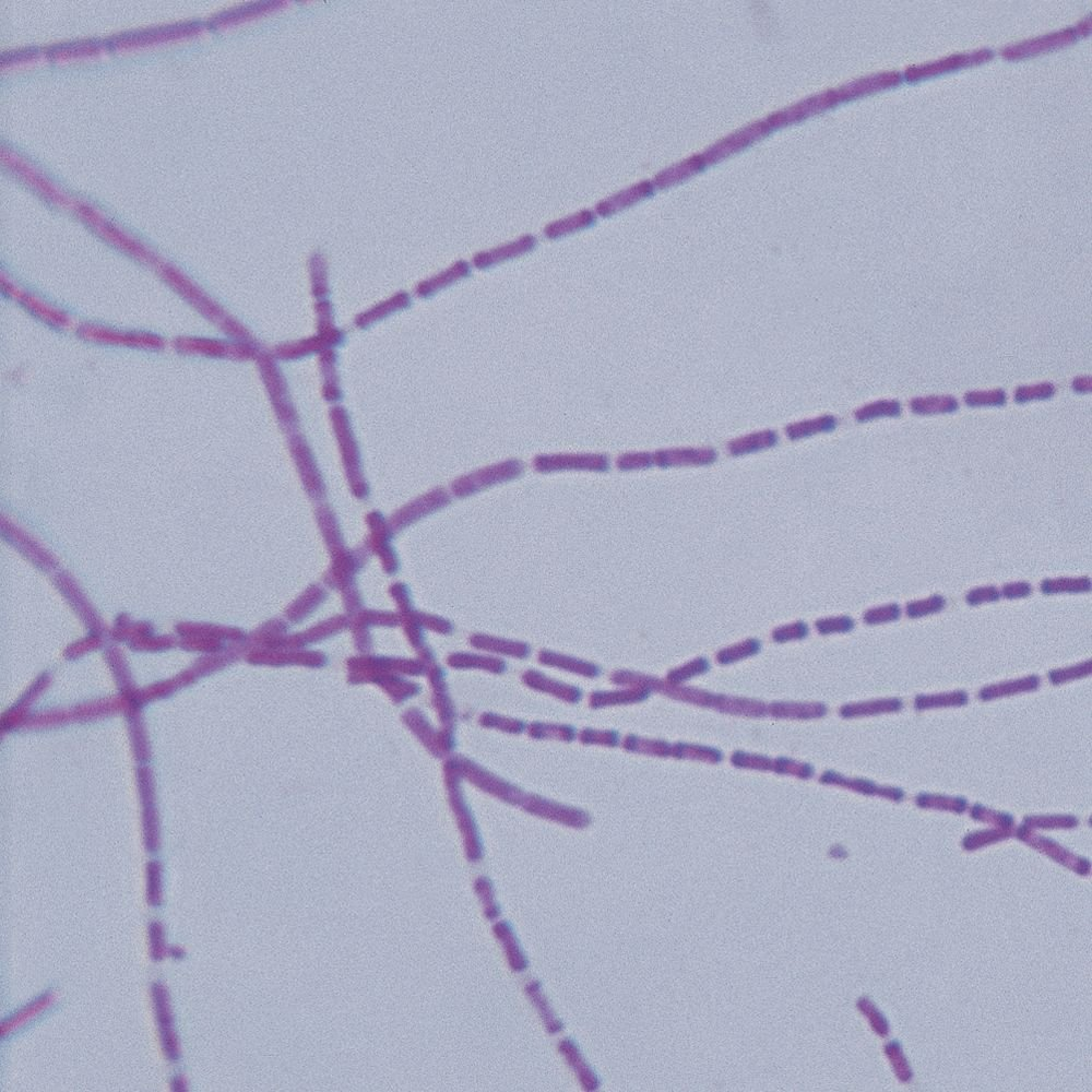 Bacterial Pathogens Microscope Slide Set, Reference Set of 12 Slides