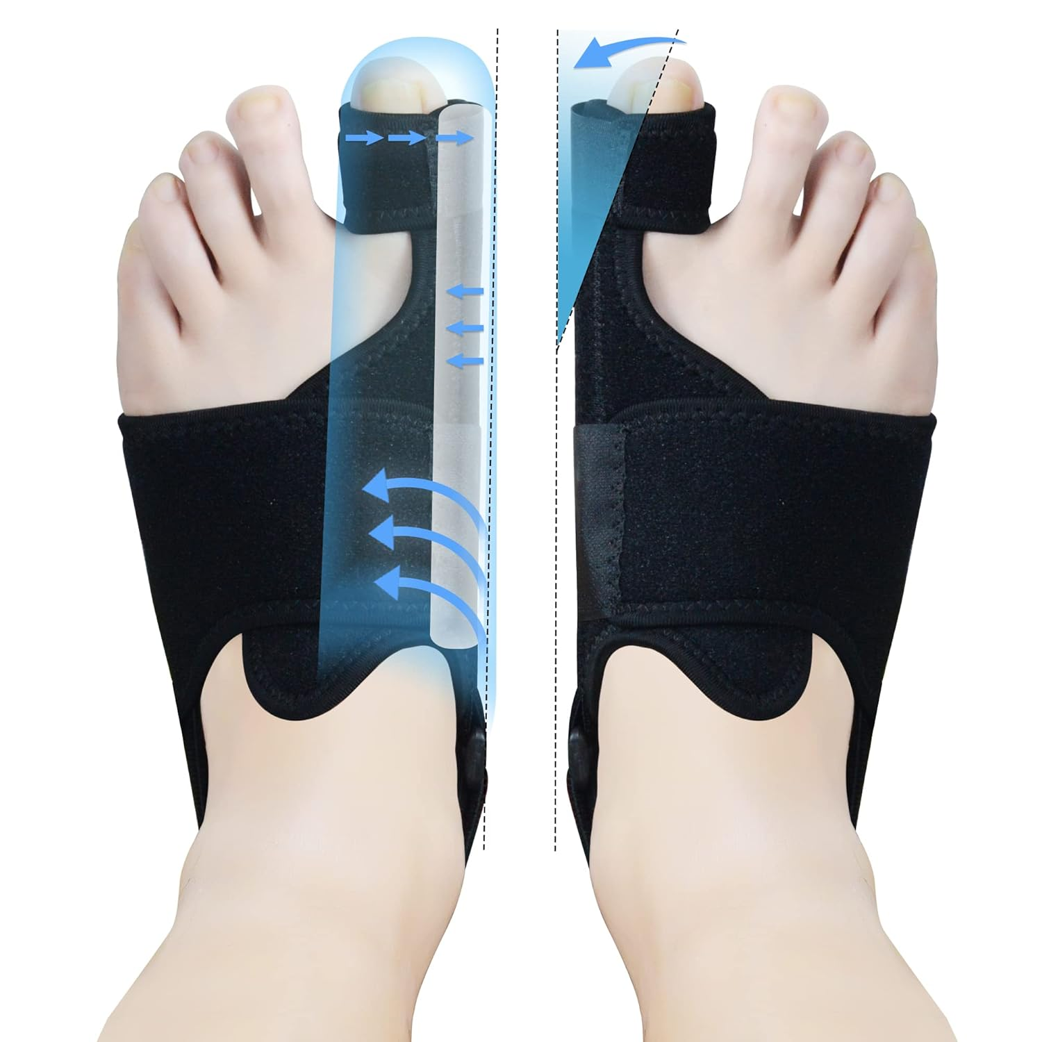 1 corrector juanetes unisex nocturno alineador dedo gordo para aliviar dolor