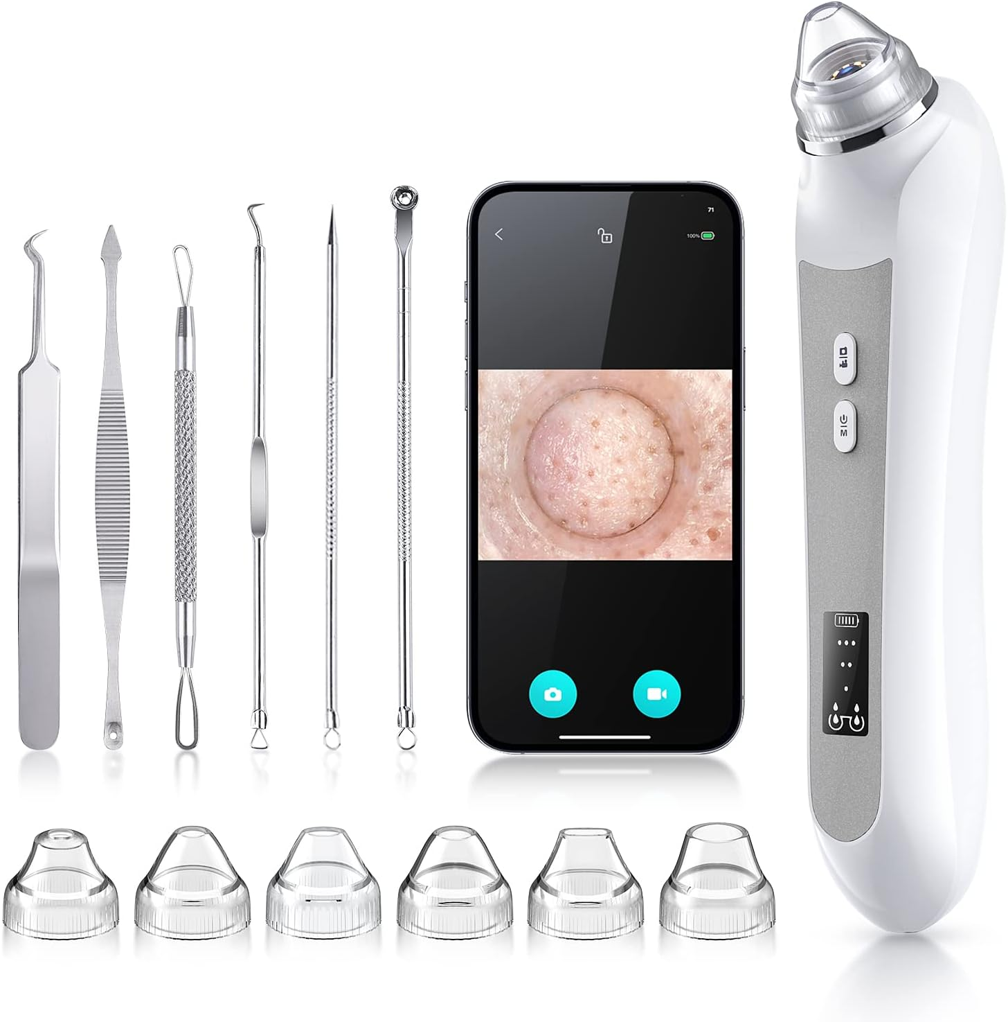 Blackhead Remover Vacuum with Camera – 6 Heads